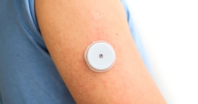 How Remote Monitoring Improves Patient Outcomes Beyond the Clinic
